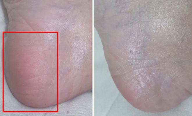品嫩白紧致身体乳：长效滋养+祛鸡皮肤电子pg游戏【仅首团送抗衰精华】新(图18)